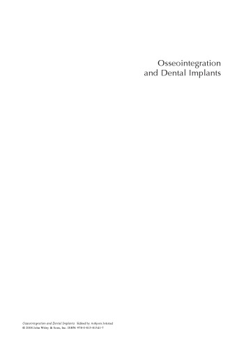﻿استخوان بندی و ایمپلنت های دندانی
