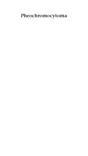 ﻿فئوکروموسیتوم: تشخیص، محلی سازی و درمان