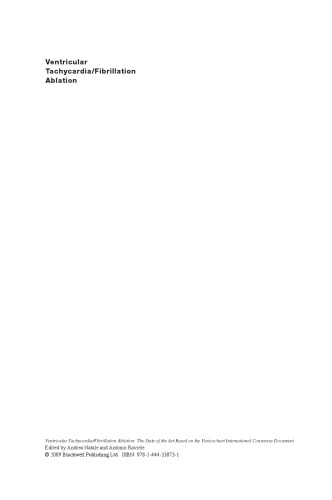 ﻿تاکی کاردی بطنی / فرسایش فیبریلاسیون: وضعیت هنر بر اساس سند اجماع بین المللی Venicechart