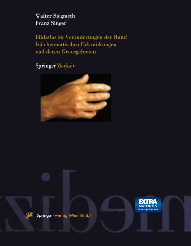 ﻿عکس اطلس تغییرات دست در بیماری های روماتیسمی و نواحی مرزی آنها