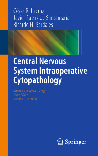 سیتوپاتولوژی حین عمل سیستم عصبی مرکزی