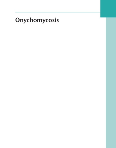 Onychomycosis: رویکرد فعلی برای تشخیص و درمان