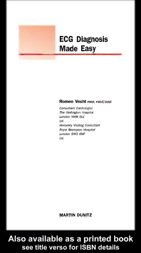 ﻿تشخیص ECG آسان شد