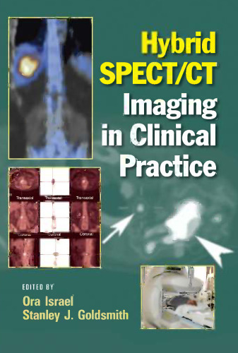 ﻿تصویربرداری هیبریدی SPECT/CT در عمل بالینی