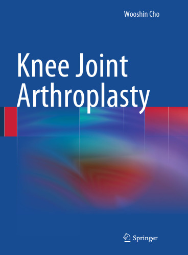 آرتروپلاستی مشترک زانو