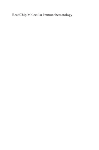 Immunohematology مولکولی BeadChip: به سوی اهداکنندگان روتین و پیشگیری از آنتی ژن بیماران توسط تجزیه و تحلیل DNA