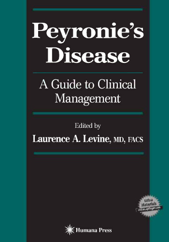 ﻿بیماری پیرونی: راهنمای مدیریت بالینی