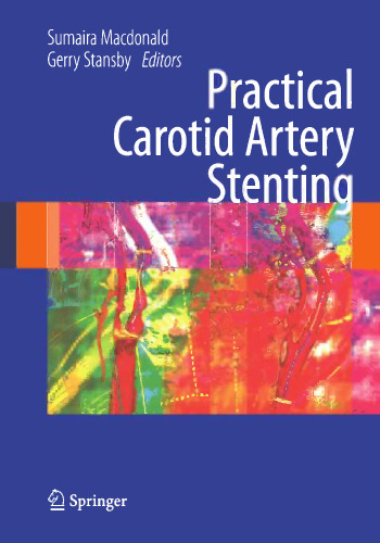 ﻿استنت گذاری عملی شریان کاروتید