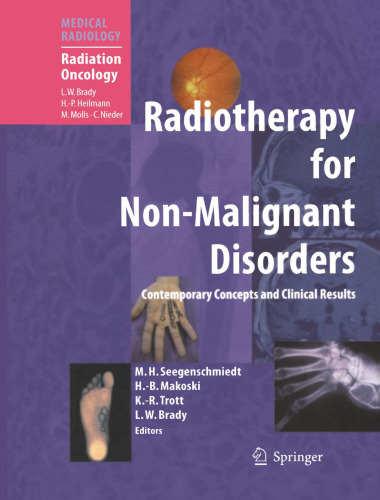 ﻿رادیوتراپی برای اختلالات غیر بدخیم
