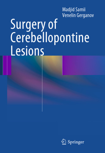 جراحی ضایعات مخچه