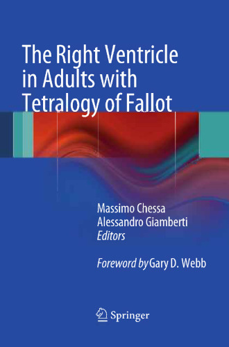 بطن راست در بزرگسالان با Tetralogy از Fallot