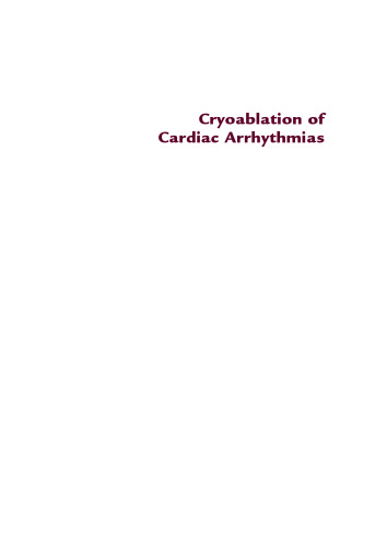 Cryoablation آریتمی قلبی