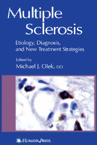 مولتیپل اسکلروزیس: اتیولوژی ، تشخیص و راهکارهای درمانی جدید