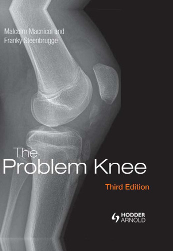 ﻿مشکل زانو: تشخیص و مدیریت در بیمار جوانتر