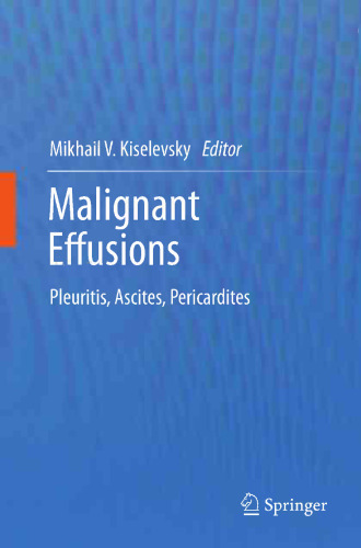 ﻿افیوژن بدخیم: پلورزی، آسیت، پریکاردیت