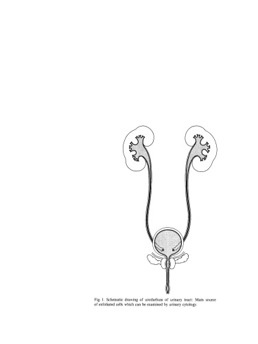 سیتولوژی ادراری: میکروسکوپ کنتراست فاز و آنالیز اسمیرهای رنگ آمیزی