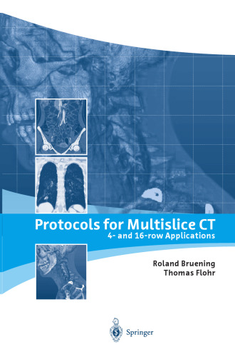 پروتکل برای برنامه های Multislice CT: برنامه های 4- و 16 ردیفی