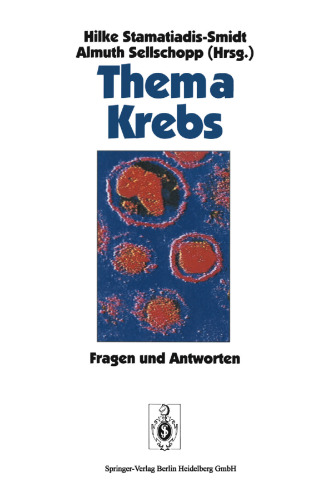 سرطان: سؤال و پاسخ