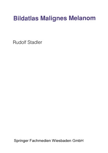 ﻿اطلس تصاویر ملانوم بدخیم