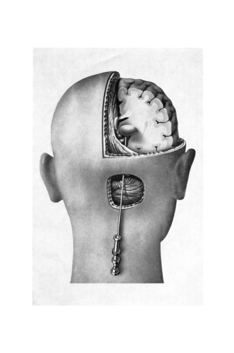 ﻿مزانسفالوتومی باز و تالاموتومی برای درد غیرقابل درمان