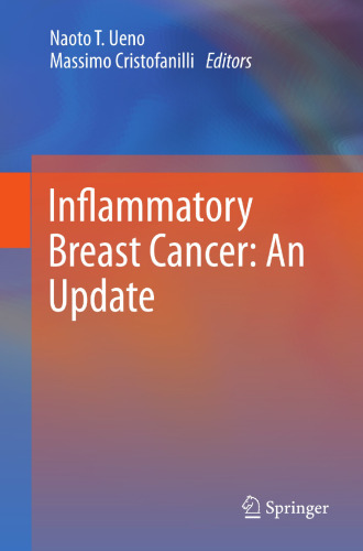 سرطان پستان التهابی: بروزرسانی