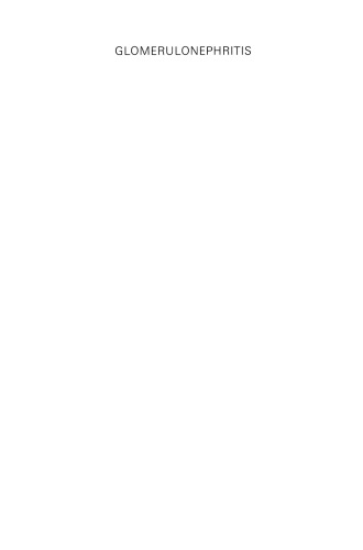 گلومرولونفریت