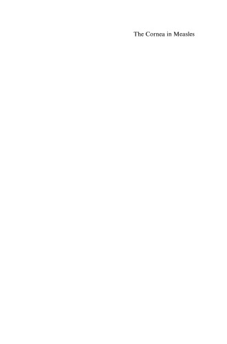 ﻿قرنیه در سرخک