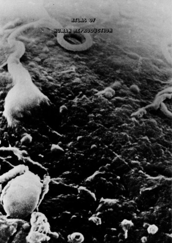 اطلس تولید مثل انسان: با اسکن میکروسکوپ الکترونی