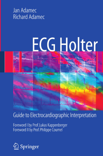﻿ECG Holter: راهنمای تفسیر الکتروکاردیوگرافی