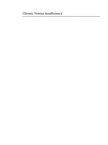 نارسایی مزمن وریدی: تشخیص و درمان