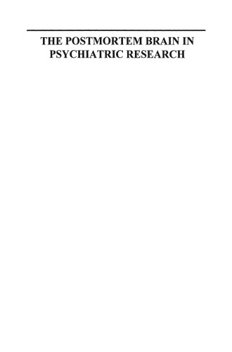 مغز Postmortem در تحقیقات روانپزشکی
