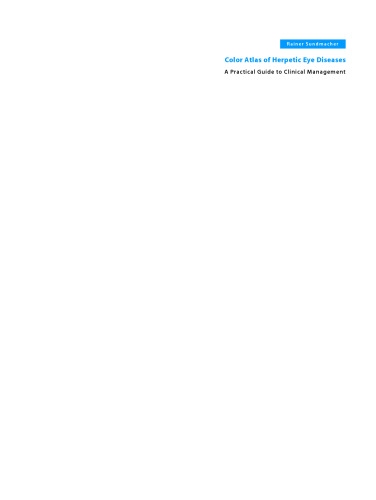 ﻿اطلس رنگی بیماری های چشم هرپتیک: یک راهنمای عملی برای مدیریت بالینی