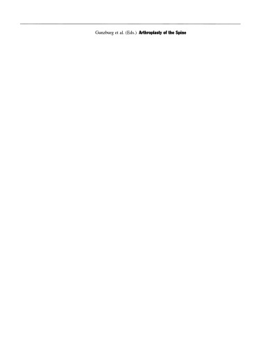 ﻿آرتروپلاستی ستون فقرات