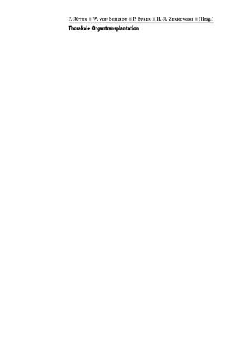 پیوند عضو در قفسه سینه: سرکوب سیستم ایمنی بدن ، جایگزین ها ، فیزیولوژی ، قانون