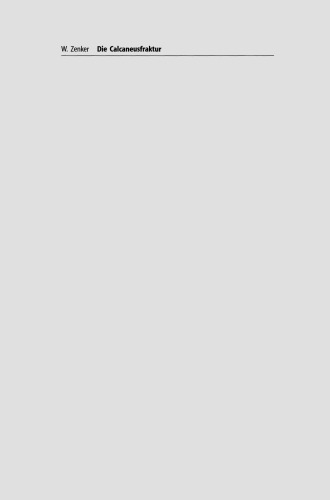 ﻿شکستگی استخوان پاشنه: تجزیه و تحلیل مدل های استخوان از داده های CT