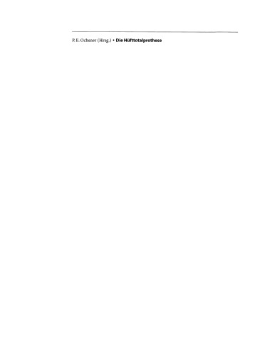 ﻿جایگزینی کامل لگن: تکنیک کاشت و عوارض موضعی