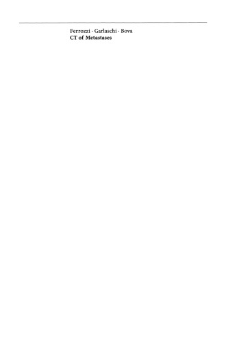 ﻿سی تی متاستازها