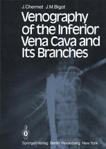 Venography ونوا کاوا و شاخه های آن