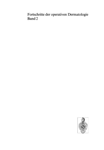 ﻿ناهنجاری های خال های ملانوما