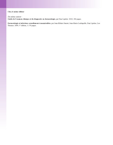 لوپوس اريتماتوز