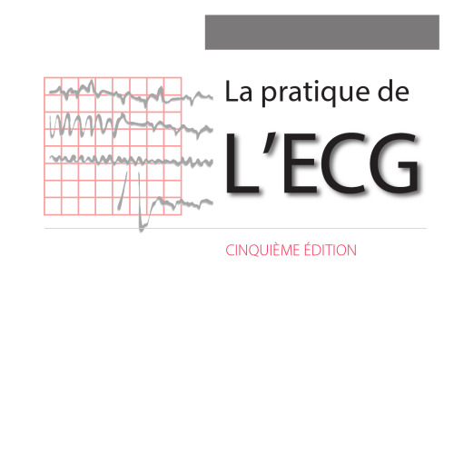 عمل ECG