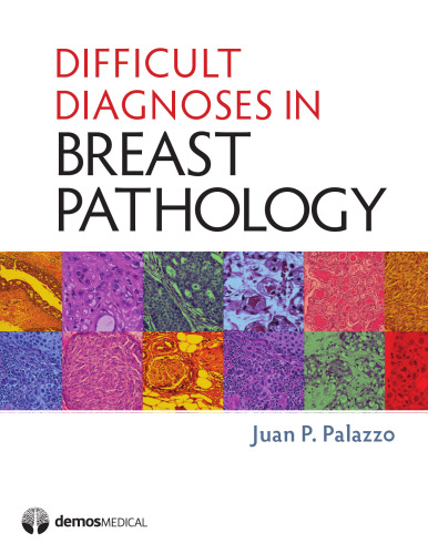 ﻿تشخیص های دشوار در آسیب شناسی پستان