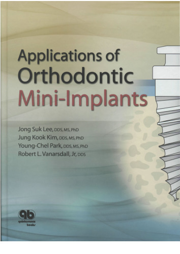 ﻿کاربردهای مینی ایمپلنت ارتودنسی