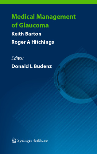 مدیریت پزشکی گلوکوم