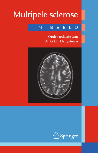 مولتیپل اسکلروزیس در تصویر