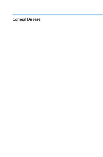 ﻿بیماری قرنیه: تحولات اخیر در تشخیص و درمان