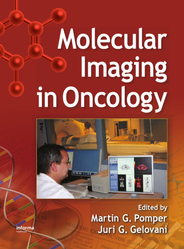 ﻿تصویربرداری مولکولی در انکولوژی
