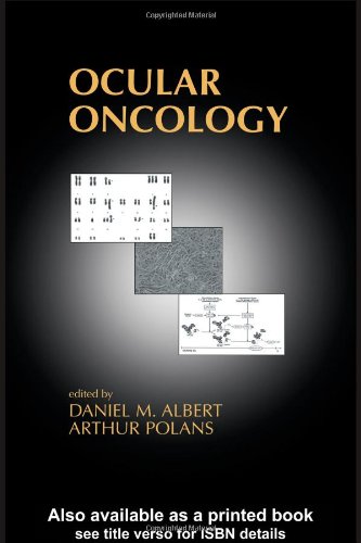 ﻿انکولوژی چشم