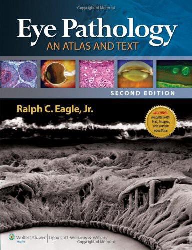 ﻿Eye Pathology An Atlas and Text ویرایش دوم