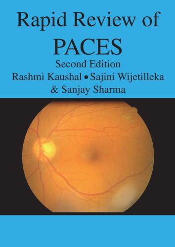 ﻿بررسی سریع PACES
